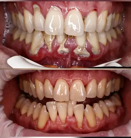 wnwdental.com