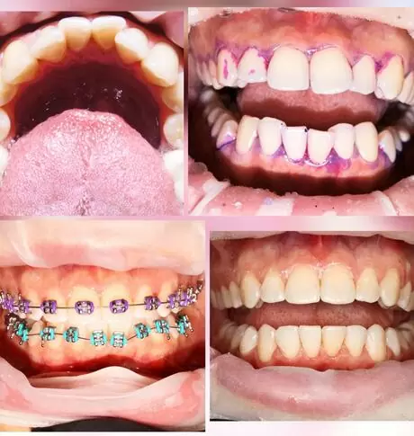 wnwdental.com